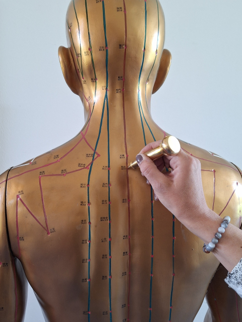 Die vergessene Nadel. Geschichte, Wiederentdeckung und moderne Praxis der Pestle Needle Therapie