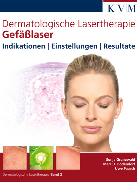 Dermatologische Lasertherapie Band 2. Gefäßlaser. Indikationen, Einstellungen, Resultate