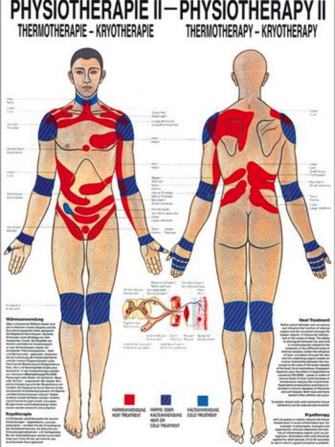 Mini-Poster - Physiotherapie 2 - Thermotherapie-Kryotherapie