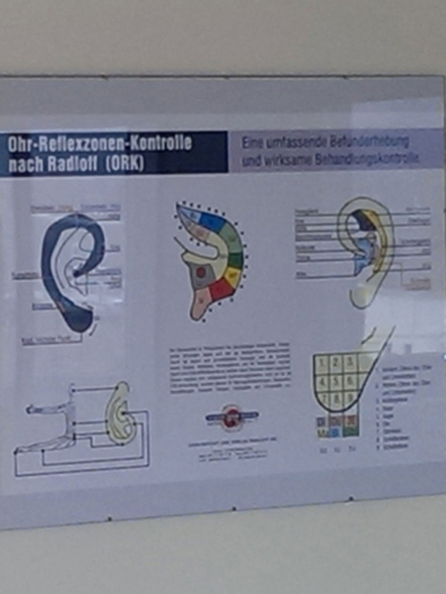 Wandtafel Ohr-Reflexzonen-Kontrolle