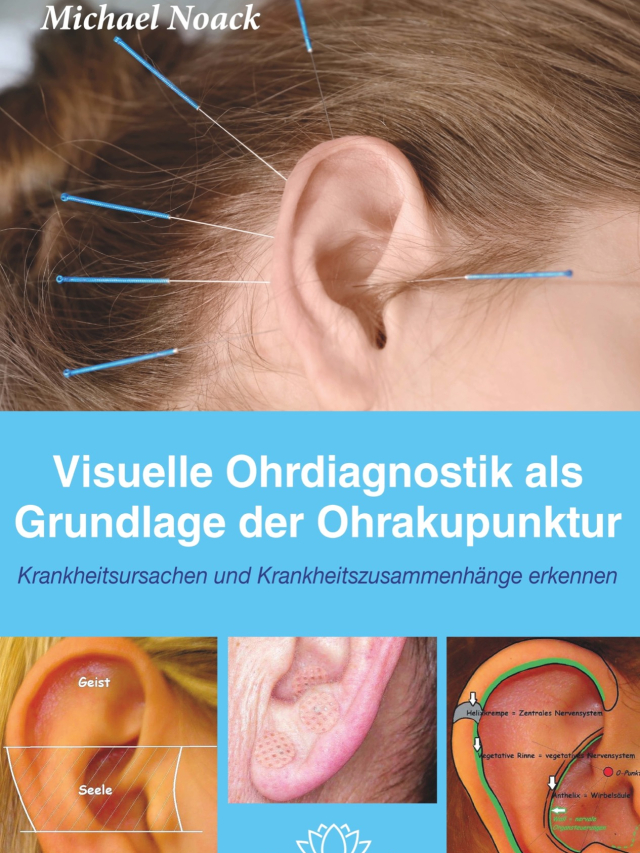 Visuelle Ohrdiagnostik als Grundlage der Ohrakupunktur