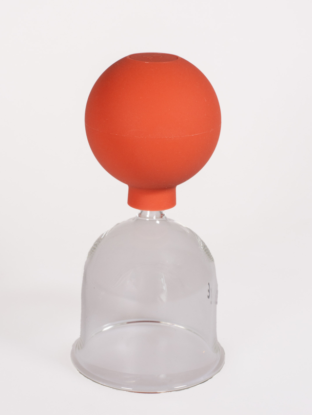 Schröpfglas mit Olive und Saugball nach Bier, ca. 6 cm Durchmesser