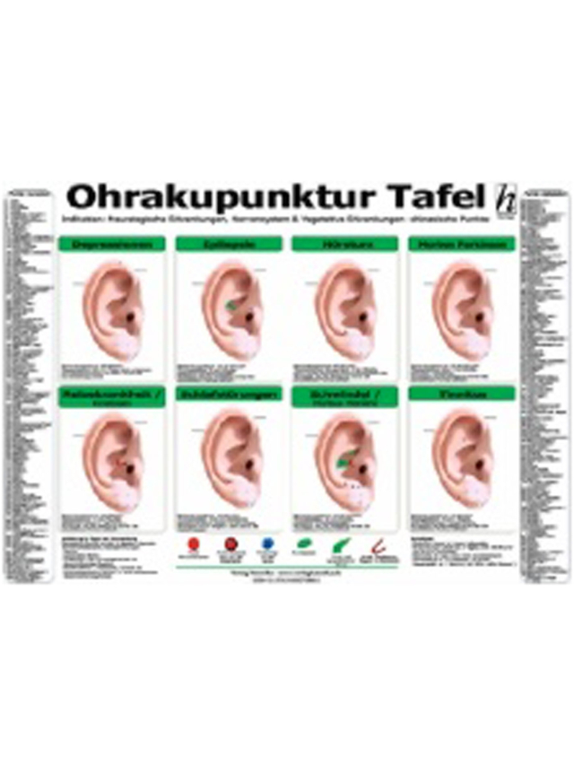 Ohrakupunktur Tafel - Indikation - Neurologische Erkrankungen, Nervensystem & Vegetative Erkrankungen