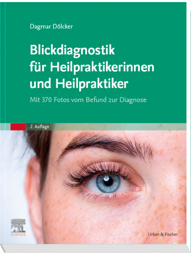 Blickdiagnostik für Heilpraktikerinnen und Heilpraktiker. Mit 370 Fotos vom Befund zur Diagnose