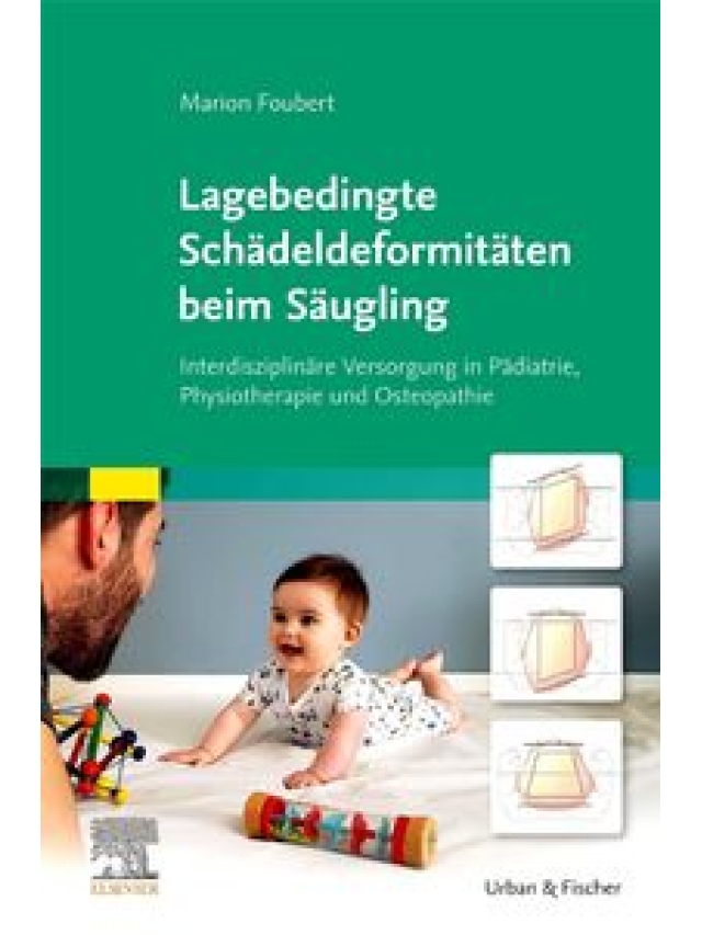 Lagebedingte Schädeldeformitäten beim Säugling