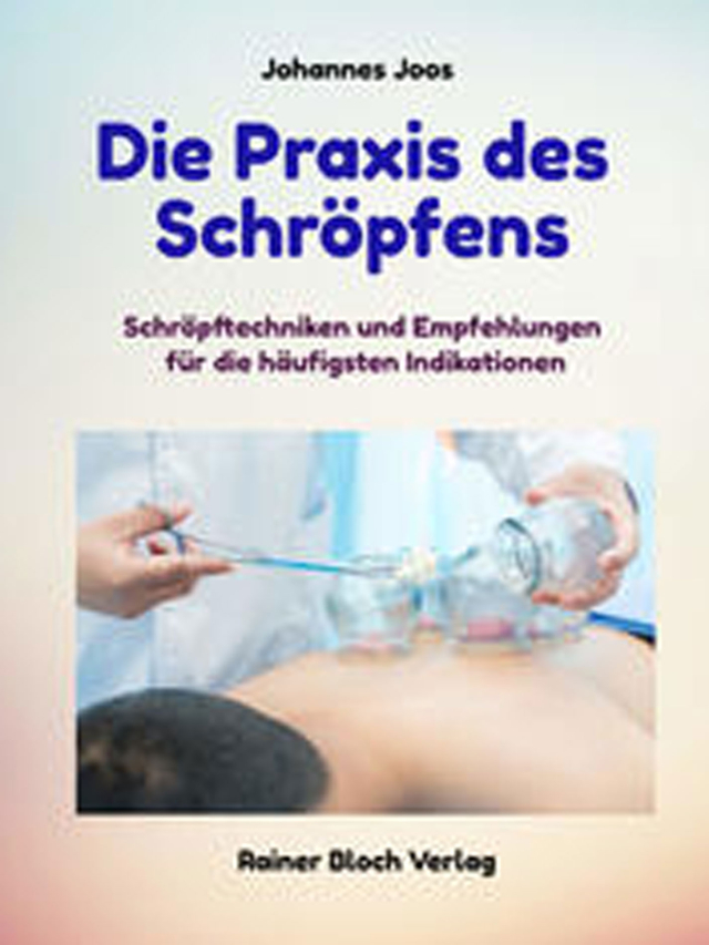 Die Praxis des Schröpfens. Schröpftechniken und Empfehlungen für die häufigsten Indikationen.