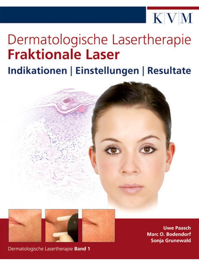 Dermatologische Lasertherapie Band 1. Fraktionale Laser