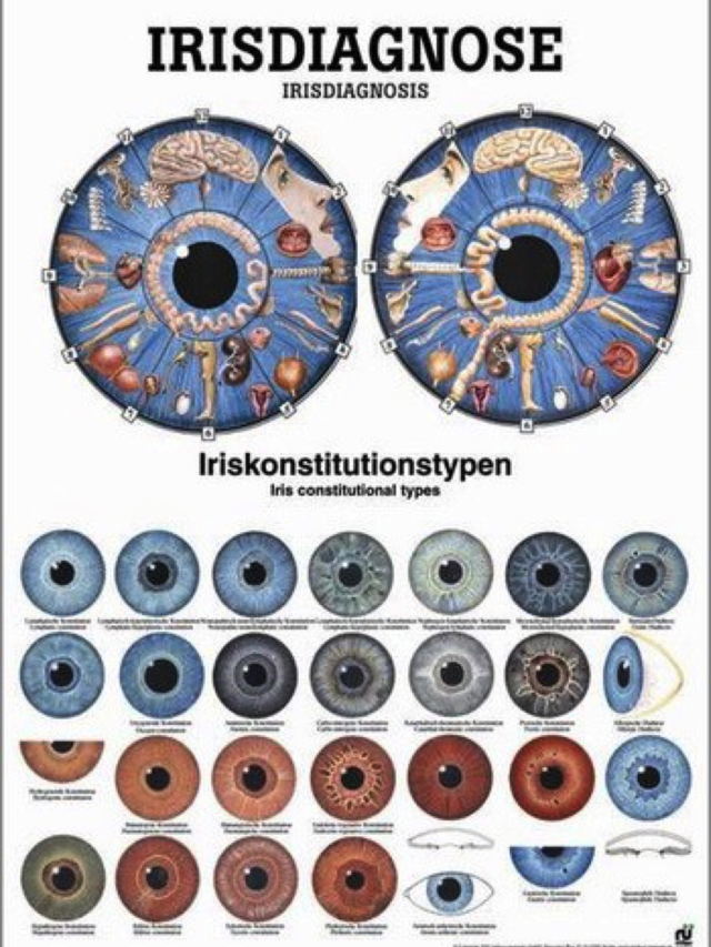 Mini-Poster - Irisdiagnose