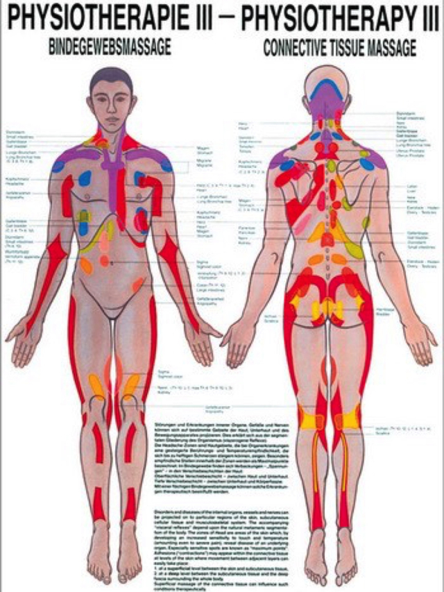 Lehrtafel Physiotherapie 3 - Bindegewebsmassage, 50 x 70 cm
