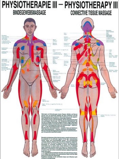 Lehrtafel Physiotherapie 3 - Bindegewebsmassage, 50 x 70 cm