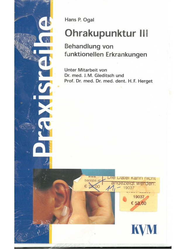 Video Ohrakupunktur III