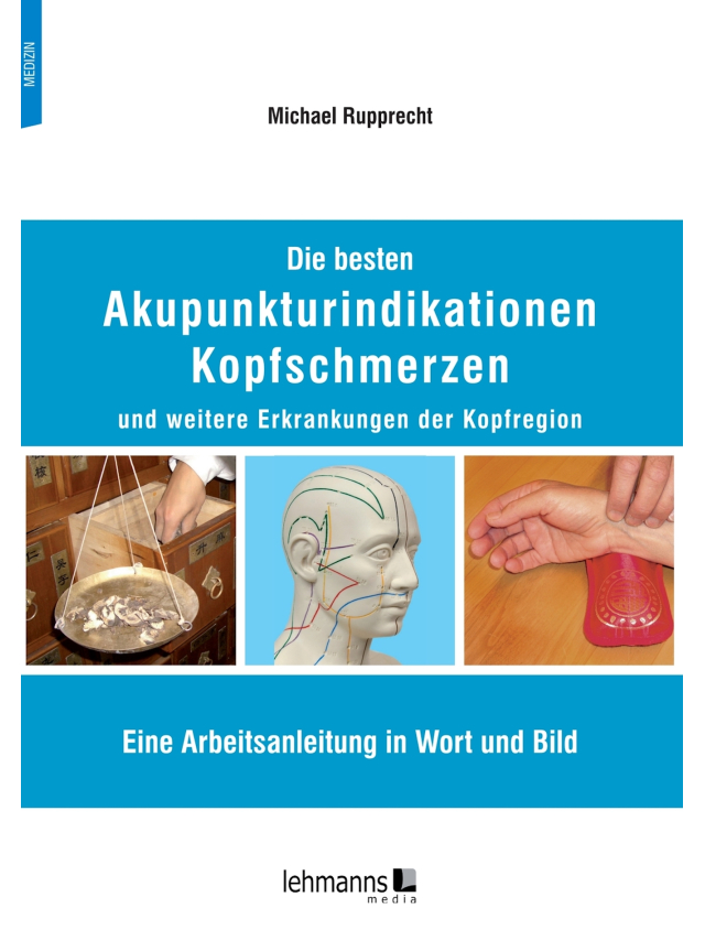 Die besten Akupunkturindikationen. Kopfschmerzen und weitere Erkrankungen der Kopfregion